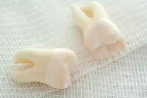 Palenie po dentyście: Uniknij suchego zębodołu! Ile czekać?