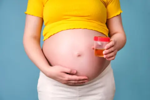 Ciężarna kobieta trzyma pojemnik z próbką moczu, badanie na obecność ketonów w moczu w ciąży.