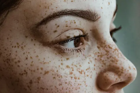 Zbliżenie na twarz z licznymi piegami, które przypominają naturalne piegi henna.