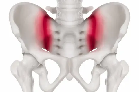 Skelettet visar bäckenet med markerad smärta i ligamenten, vanligt vid graviditet.
