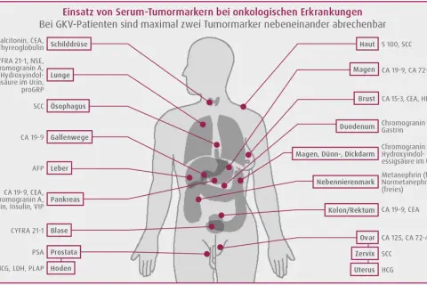 Schema zeigt Tumormarker wie CEA für verschiedene Organe, z.B. Lunge, Pankreas, Kolon/Rektum, zur Diagnose onkologischer Erkrankungen.
