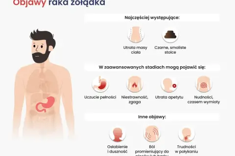 Ilustracja przedstawia objawy raka żołądka: utratę masy ciała, czarne stolce, uczucie pełności, niestrawność, zgagę, utratę apetytu, nudności, wymioty, osłabienie, duszność, ból pleców i trudności w połykaniu.