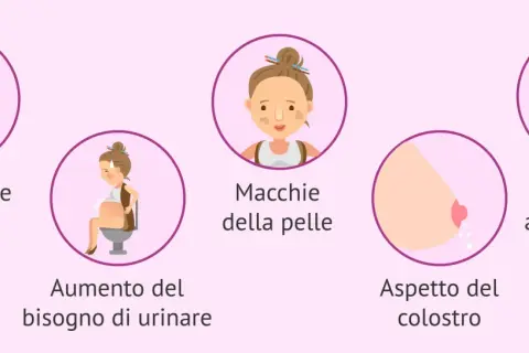 Sintomi ciclo ma non arriva: smagliature, aumento bisogno di urinare, macchie pelle, colostro, problemi schiena.