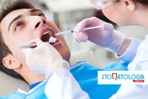 Jak szybko pozbyć się znieczulenia u dentysty? Sprawdzone rady