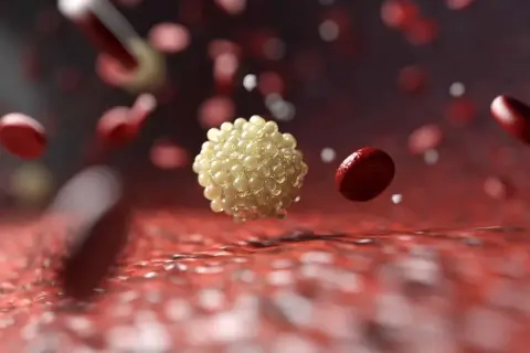 Aggregato di LDL ossidate, potenzialmente dannose, fluttua tra globuli rossi nel flusso sanguigno.