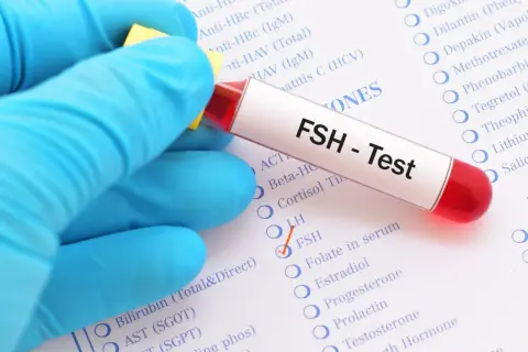 Ręka w niebieskiej rękawiczce trzyma probówkę z napisem "FSH - Test". Obok zaznaczono opcję FSH na liście badań.