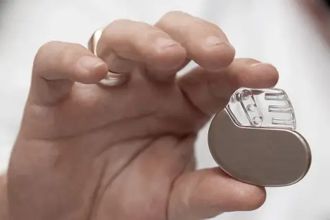 Dłoń trzymająca niewielki pacemaker. Dzięki niemu można wrócić do aktywności, nawet do biegania.