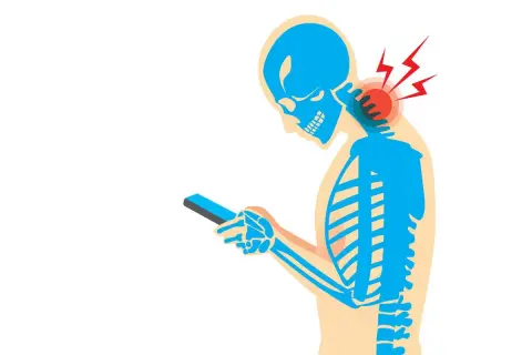 Squelette bleu regardant un téléphone, avec des éclairs rouges symbolisant les douleurs cervicales dues au stress.
