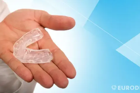 Mano che tiene un bite apparecchio trasparente, utile per proteggere i denti durante il sonno o lo sport.