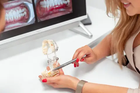 Dentystka omawia z pacjentem proces zakładania korony na zęba, używając modelu szczęki.