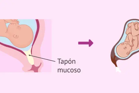 Ilustración muestra un bebé en el útero y el tapón mucoso, seguido de un bebé listo para nacer.