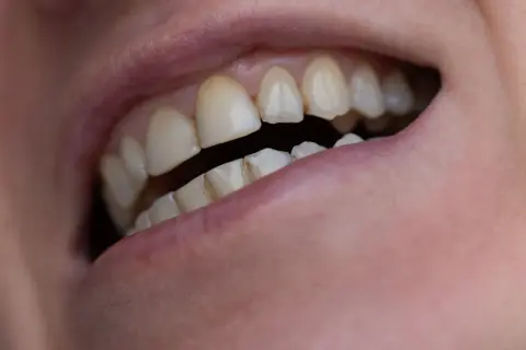 Zbliżenie na usta i zęby. Widać wyraźnie górne i dolne zęby, niektóre lekko przebarwione. Czy kazdy ma 8 zębów? To pytanie nurtuje wielu.