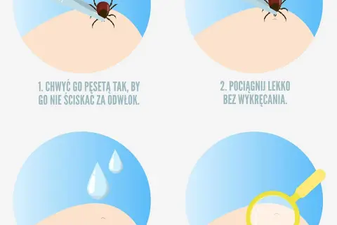 Co zrobić po wyciągnięciu kleszcza? Kluczowe kroki, aby uniknąć problemów