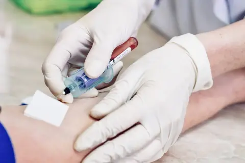 Czy badania krwi wykryją raka? Fakty i ograniczenia diagnostyki
