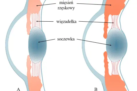 Jak działa soczewka oka i dlaczego ma kluczowe znaczenie dla wzroku