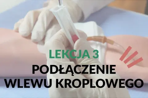Jak podłączyć kroplówkę instrukcja - uniknij błędów i komplikacji