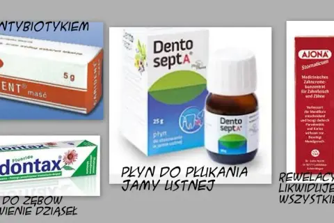Jakie leki na zapalenie dziąseł? Skuteczne metody leczenia