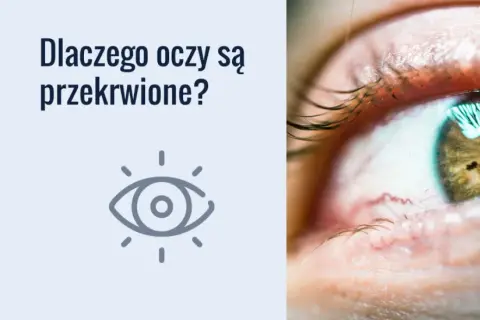 Dlaczego konie mają zasłonięte oczy? Powody, korzyści i zastosowanie klapek