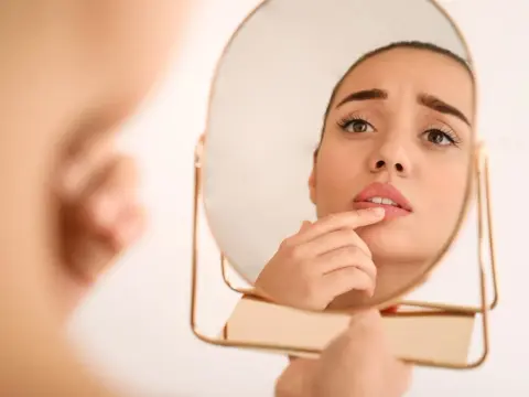 Afte da stress - come riconoscerle e quando preoccuparsi