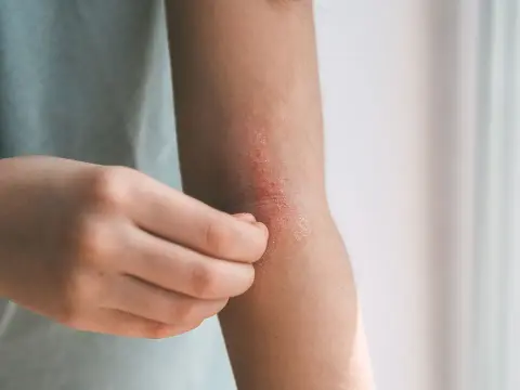 Wizyta u dermatologa - kiedy nie zwlekać i jak się przygotować?