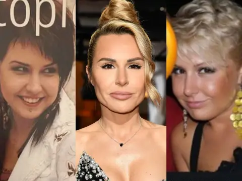 Blanka Lipińska przed operacjami - Jak naprawdę wyglądała?