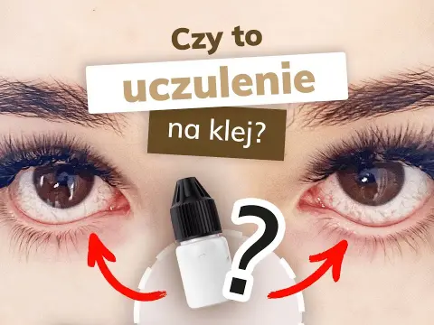 Alergia na klej do rzęs: Objawy, leczenie i co robić krok po kroku