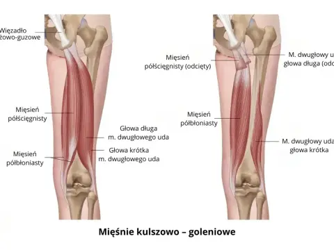 Ból podudzia - jak odróżnić przeciążenie od stanu pilnego?