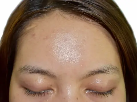 Sebum - co to jest? Mądra pielęgnacja cery tłustej i świecącej