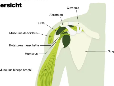 Schmerz am Schulterblatt - Was dahinter steckt & was hilft