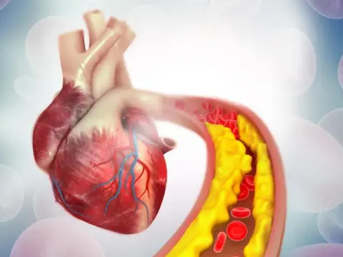 Twój cholesterol: Jak zbadać, zrozumieć wyniki i chronić serce?