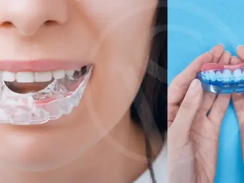 Cómo evitar el bruxismo y proteger tus dientes