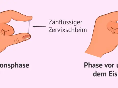Eisprung Symptome richtig deuten - Warnzeichen erkennen und abklären