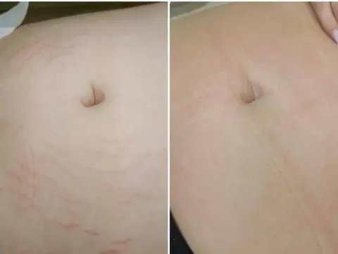 Gdzie kupić deep phyto peeling i uniknąć nieefektywnych produktów