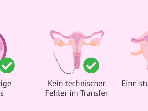 Hochwertige Embryos und kein technischer Fehler im Transfer sind wichtig. Eine Einistungsstörung kann das verhindern.