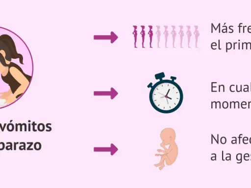 Ilustración de mujer con náuseas y vómitos en el embarazo, más comunes en el primer trimestre, pueden ocurrir a cualquier hora y no afectan la gestación.