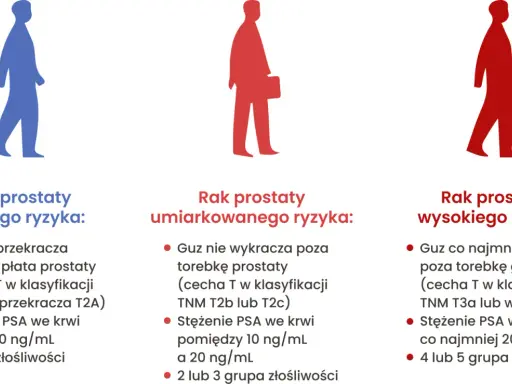 Ilustracja pokazuje trzy sylwetki mężczyzn, symbolizujące różne stadia raka prostaty: niskiego, umiarkowanego i wysokiego ryzyka. Opisuje, jak wygląda badanie prostaty w zależności od stopnia zaawansowania.