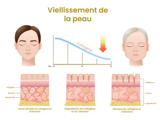 Le vieillissement cutané montre une baisse du collagène, entraînant rides et perte d'élasticité. Quels sont les effets indésirables du collagène ? L'image illustre la dégradation.