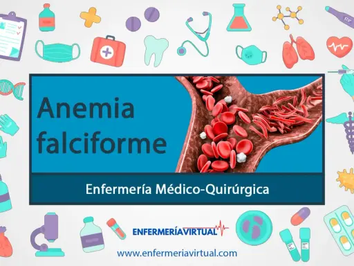 Anemia falciforme: glóbulos rojos con forma de hoz bloquean el flujo sanguíneo. Ilustración médica con iconos de salud.