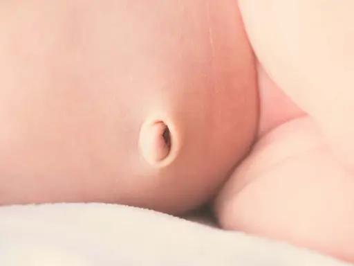Primer plano de la piel de un bebé, mostrando un ombligo con una leve hernia umbilical.