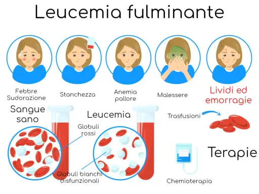 Leucemia fulminante: febbre, stanchezza, anemia, malessere, lividi. Globuli bianchi disfunzionali. Terapie: trasfusioni, chemioterapia.