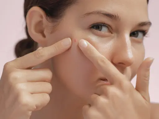 Une femme examine un furoncle sur son visage, ses doigts pointant vers la petite imperfection rouge sur sa joue.