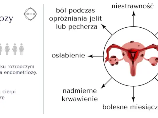 Objawy endometriozy: ból, niestrawność, bezpłodność, mdłości, bolesny stosunek, bolesne miesiączki, nadmierne krwawienie, osłabienie. Leczenie często obejmuje hormony na endometriozę.