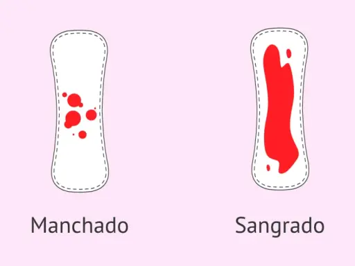 Dos compresas: una con manchado leve y otra con sangrado abundante. Puede ser un signo de embarazo con la regla.
