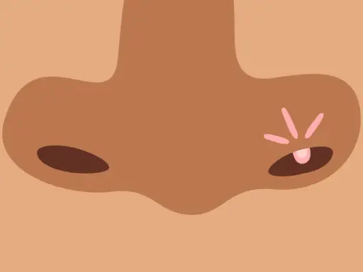 Gros plan sur un nez avec un bouton rose et des rayons de lumière.
