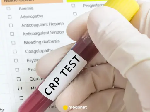 Ręka w rękawiczce trzyma probówkę z krwią z napisem "CRP TEST" na tle listy badań.