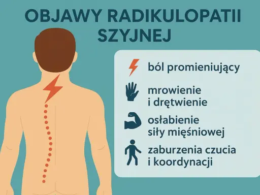 Grafika ilustruje objawy radikulopatii szyjnej: piekący ból kręgosłupa szyjnego, mrowienie, osłabienie mięśni i zaburzenia koordynacji.