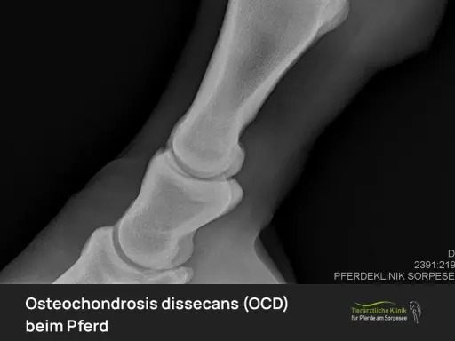 Röntgenbild eines Pferdefußes mit OCD (Osteochondrosis dissecans). Die Aufnahme zeigt die Knochenstruktur und mögliche Veränderungen.