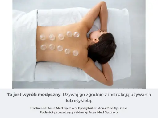 Kobieta leży na plecach, na jej kręgosłupie umieszczono przezroczyste bańki.