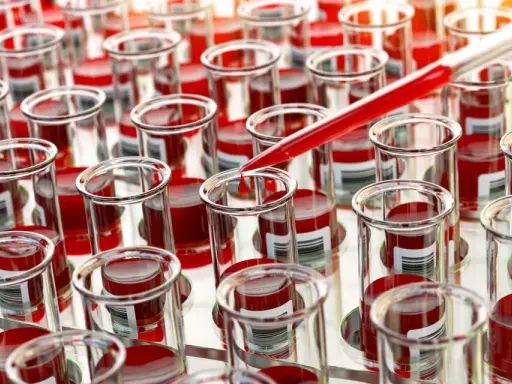 Próbówki z krwią do badań nad ostrą białaczką szpikową. Kropelka krwi spada z pipety, symbolizując postęp w diagnostyce i leczeniu.