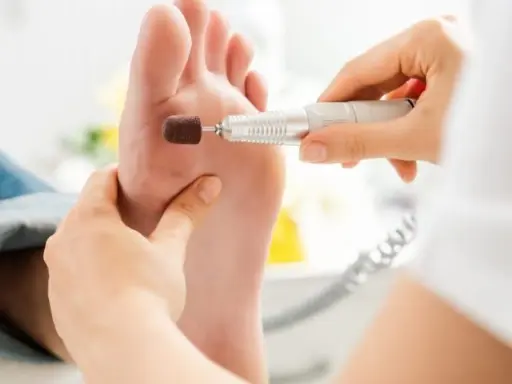 Un podologue utilise une fraise pour traiter un pied. Une ordonnance est-elle nécessaire pour ce soin ?